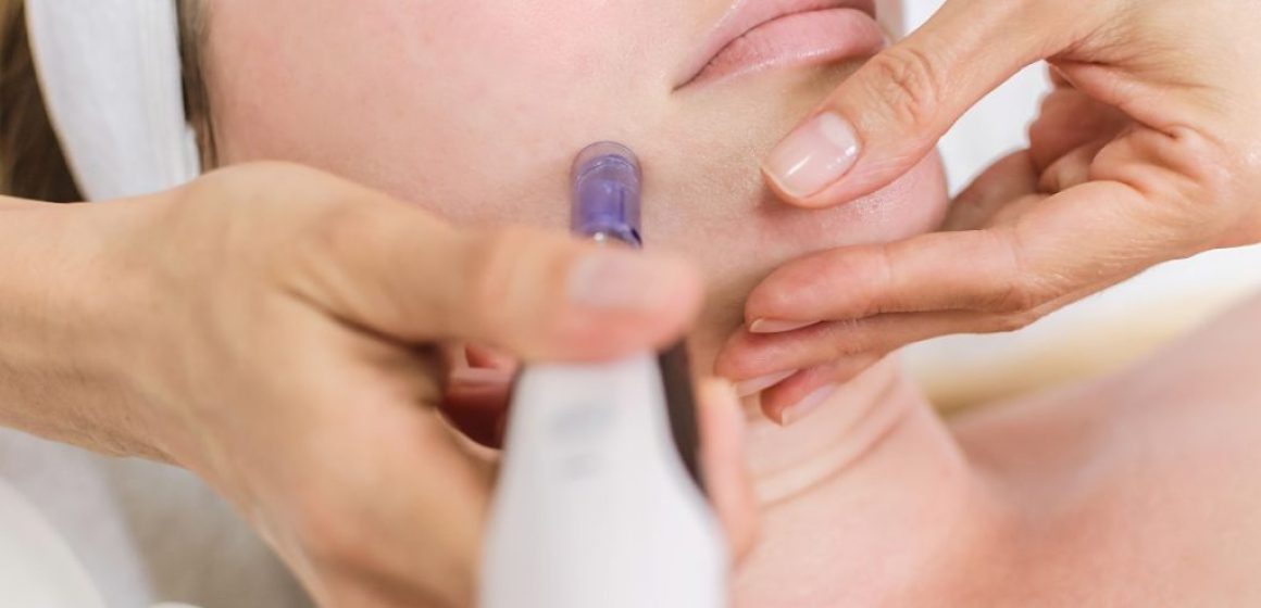 Dermapen: rejuvenece tu piel de forma natural