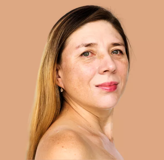 Tratamiento Eliminar manchas en la piel - Clínica Integral