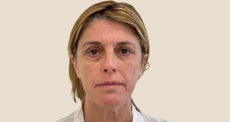 Bioestimuladores Antes Sin Fondo Clinica Integral