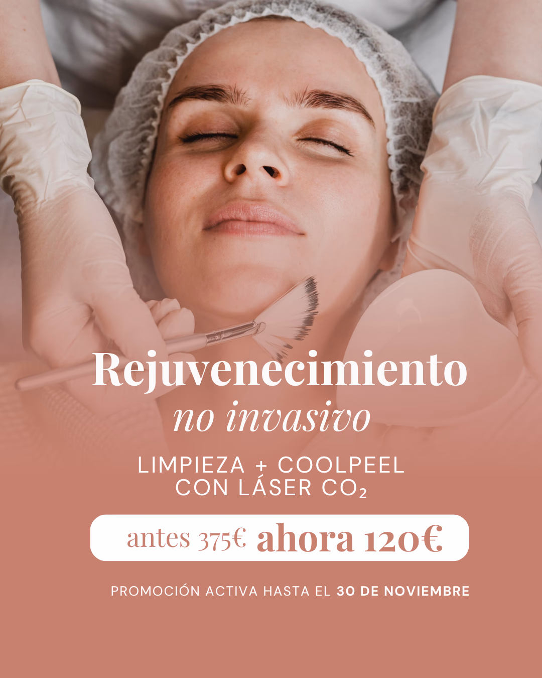 Clinica Integral - Promociones Noviembre - Rejuvenecimiento no invasivo