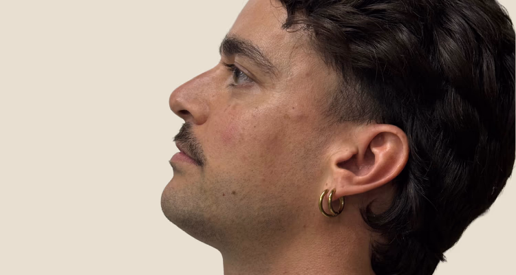 Rinomodelacion 01 Clinica Integral