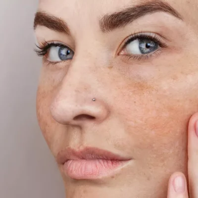 Despigmentación en la piel: causas y cómo mejorarla